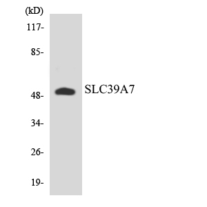 Western blot analysis of the lysates from HUVECcells using SLC39A7 antibody