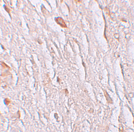 a07719 2 slc39a7 primary antibodies ihc testing 6
