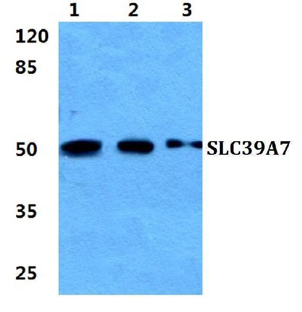 Western blot (WB) analysis of SLC39A7 polyclonal antibody at 1:500 dilution
Lane1:Hela cell lysate
Lane2:sp2/0 cell lysate
Lane3:H9C2 cell lysate