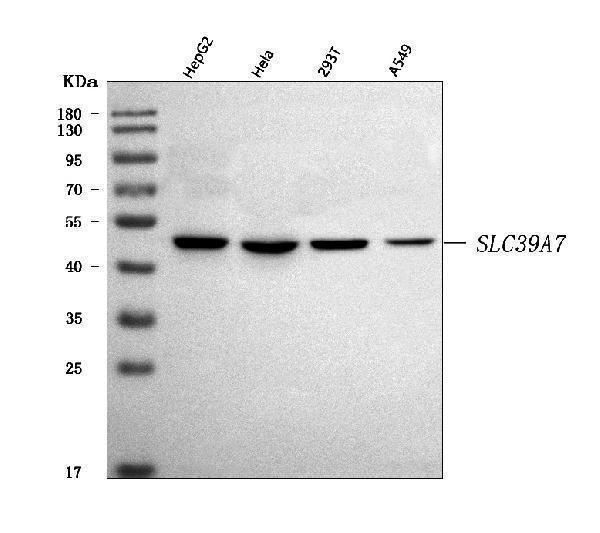 Western blot analysis of ZIP7/SLC39A7 using anti-ZIP7/SLC39A7 antibody (A07719-4)