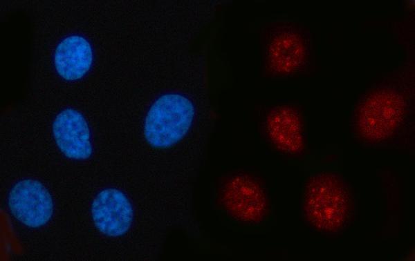  IF analysis of RFC2 using anti-RFC2 antibody (A07724-1)
