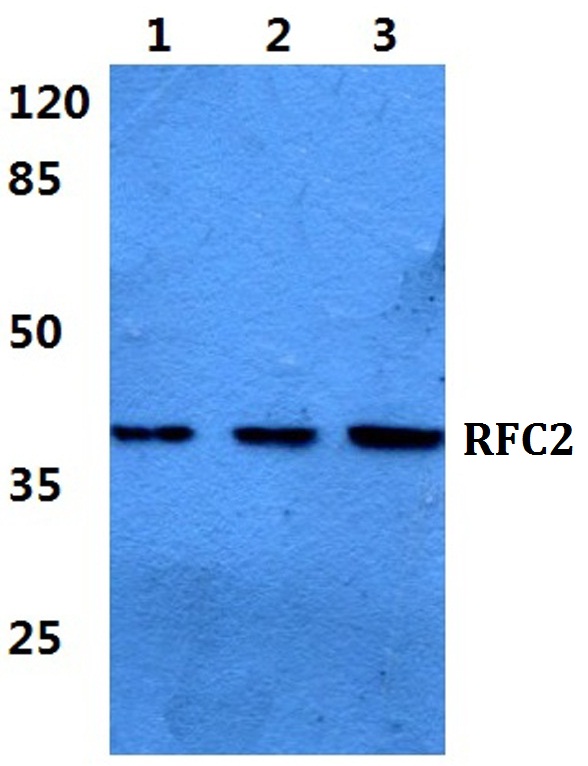 Western blot (WB) analysis of RFC2 polyclonal antibody at 1:500 dilution
Lane1:HEK293T cell lysate
Lane2:Raw264