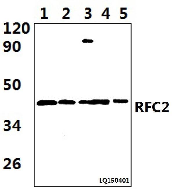 Western blot (WB) analysis of RFC2 (T165) polyclonal antibody at 1:1000 dilution   
Lane1:MCF-7 whole cell lysate(48ug)   Lane2:The Intestines tissue lysate of Rat(25ug)  
Lane3:The Intestines tissue lysate of Mouse(35ug)   Lane4:The Lung tissue lysate of Rat(39ug)   Lane5:The Lung tissue lysate of Mouse(38ug) 