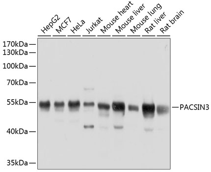 a07725 pacsin3 primary antiboties wb testing 1