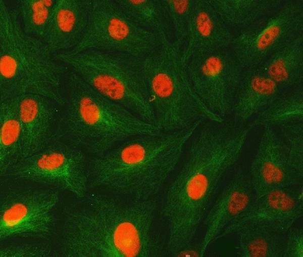 a07728 snrpc primary antibodies if testing 13