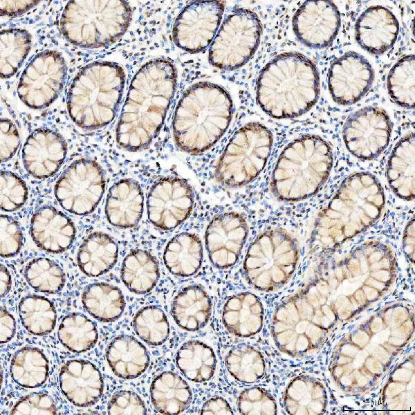a07728 snrpc primary antibodies ihc testing 3