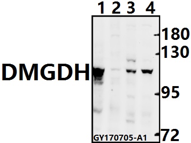 Western blot (WB) analysis of DMGDH polyclonal antibody at 1:500 dilution
Lane1:CT26 whole cell lysate(40ug)
Lane2:H9C2 whole cell lysate(40ug)
Lane3:L02 whole cell lysate(40ug)
Lane4:MCF-7 whole cell lysate(40ug)