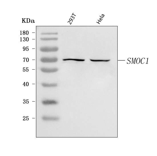 Western blot analysis of SMOC1 using anti-SMOC1 antibody (A07736)