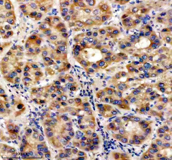 IHC analysis of UBE2W using anti-UBE2W antibody (A07737-1)