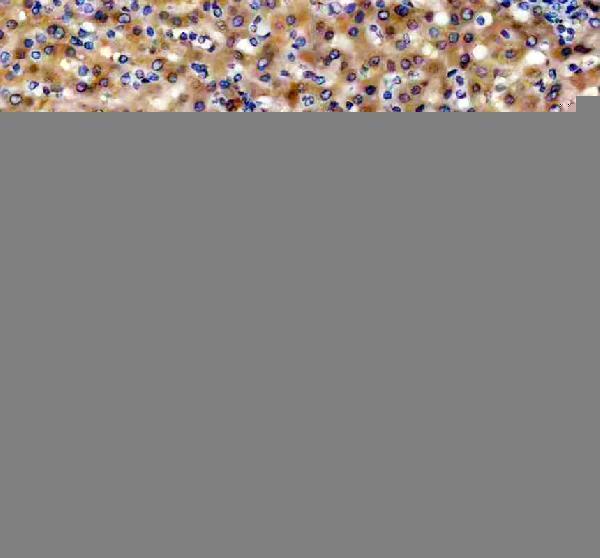 IHC analysis of UBE2W using anti-UBE2W antibody (A07737-1)