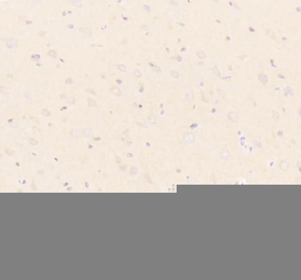 a07737 1 ube2w primary antibodies ihc testing 4