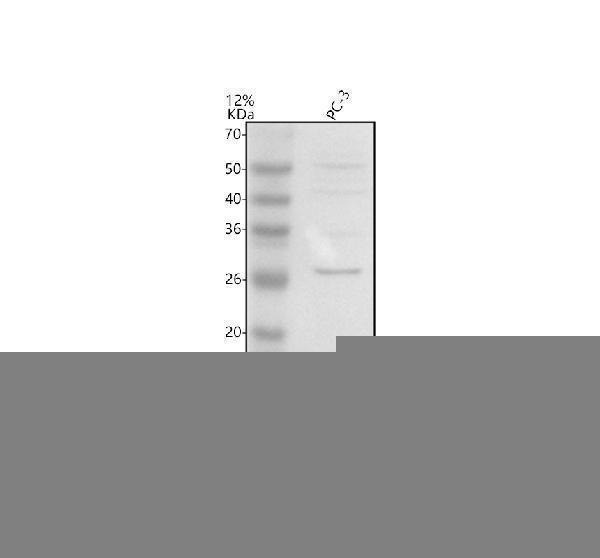 Western blot analysis of UBE2W using anti-UBE2W antibody (A07737-1)