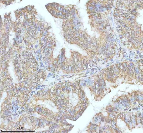 IHC analysis of DIS3l2 using anti-DIS3l2 antibody (A07738-1)