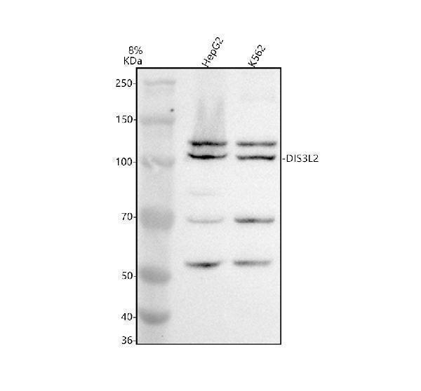 Western blot analysis of DIS3l2 using anti-DIS3l2 antibody (A07738-1)