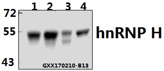 Western blot (WB) analysis of hnRNP H (R192) polyclonal antibody at 1:500 dilution
Lane1:Hela whole cell lysate(40ug)
Lane2:L02 whole cell lysate(40ug)
Lane3:C6 whole cell lysate(40ug)
Lane4:CT26 whole cell lysate(40ug)