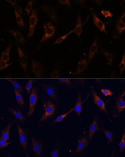 a07743 vps25 primary antiboties if testing 2