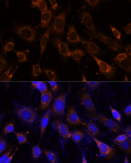 a07743 vps25 primary antiboties if testing 3