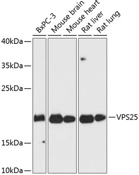 a07743 vps25 primary antiboties wb testing 1