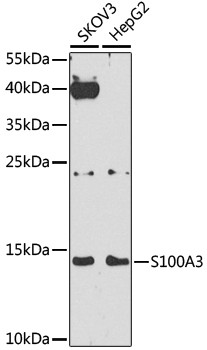 Western blot analysis of extracts of various cell lines, using S100A3 antibody  at 1:1000 dilution