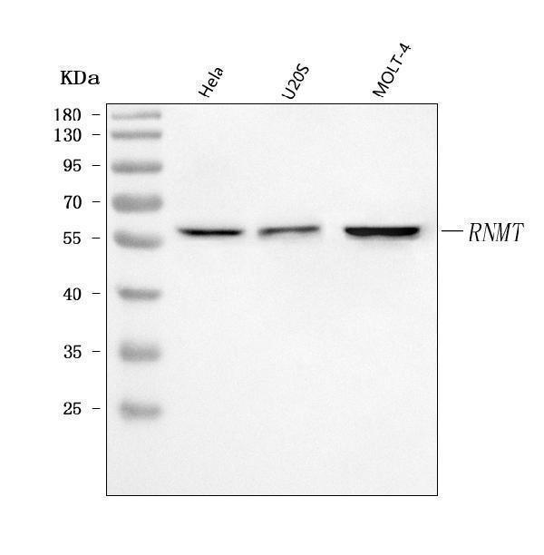  Western blot analysis of RNMT using anti-RNMT antibody (A07752-1)