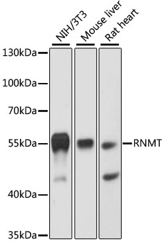 Western blot analysis of extracts of various cell lines, using RNMT antibody  at 1:3000 dilution