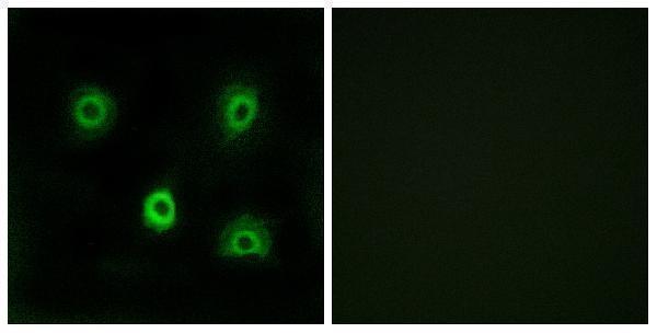 Immunofluorescence analysis of A549 cells, using ABHD6 Antibody
