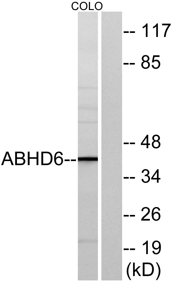 Western blot analysis of lysates from COLO cells, using ABHD6 Antibody