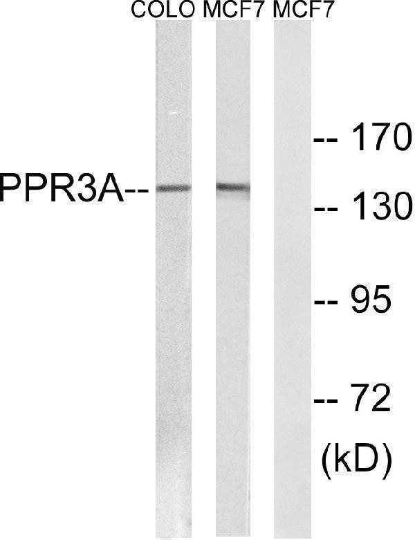 Western blot analysis of lysates from MCF-7 and COLO cells, using PPP1R3A Antibody