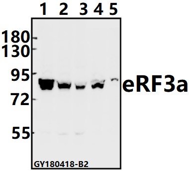 Western blot (WB) analysis of eRF3a (D128) pAb at 1:500 dilution
Lane1:SGC7901 whole cell lysate(40ug)
Lane2:Panc1 whole cell lysate(40ug)
Lane3:PC3 whole cell lysate(40ug)
Lane4:AML-12 whole cell lysate(40ug)
Lane5:PC12 whole cell lysate(40ug)
