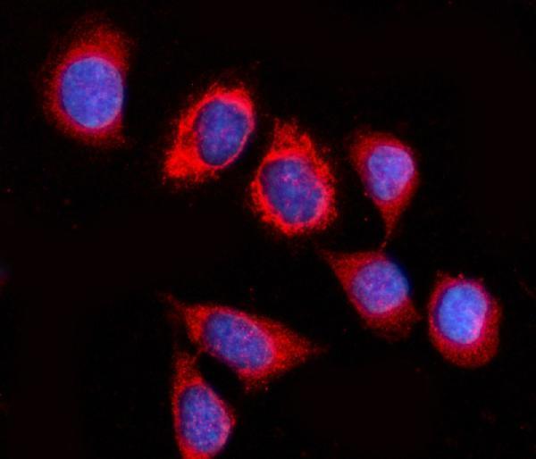a07761 2 gspt1 2 primary antibodies if testing 5