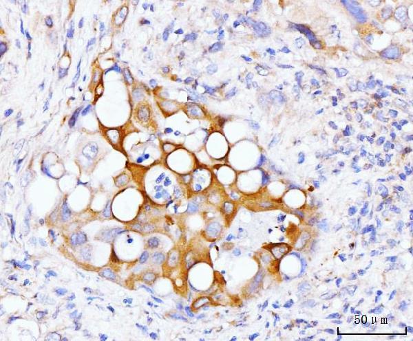  IHC analysis of GSPT1,2 using anti-GSPT1,2 antibody (A07761-2)