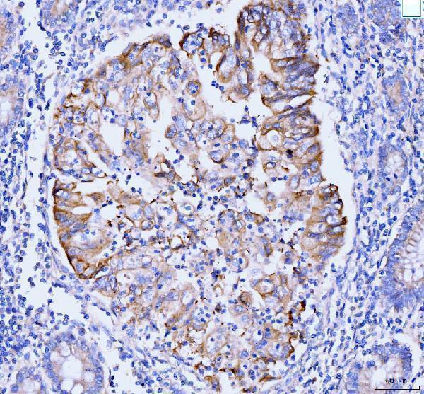  IHC analysis of GSPT1,2 using anti-GSPT1,2 antibody (A07761-2)