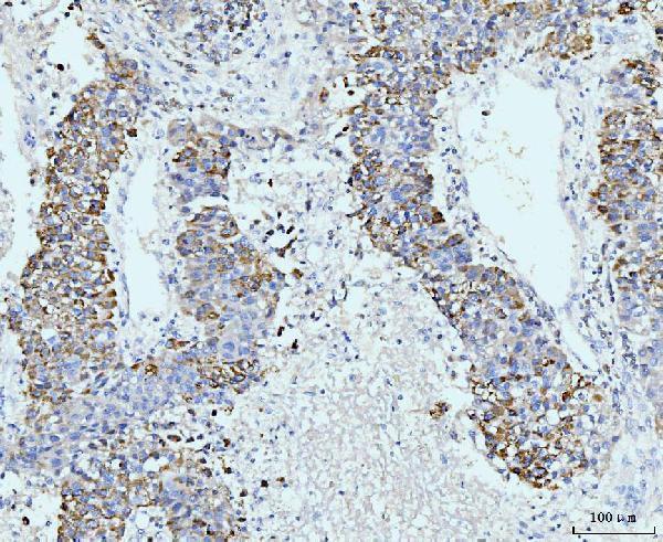 a07761 2 gspt1 2 primary antibodies ihc testing 4