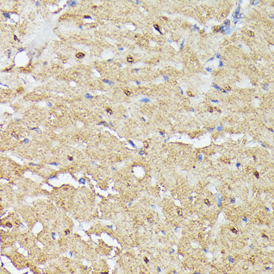 Immunohistochemistry of paraffin-embedded rat heart using TRIP4 antibody  at dilution of 1:100 