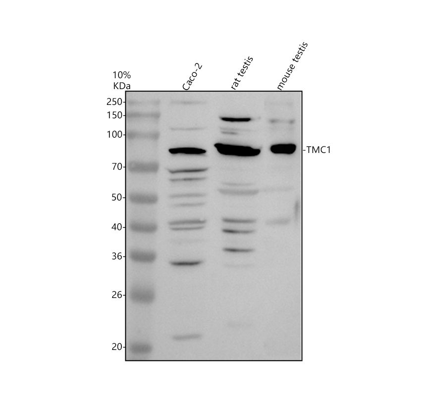 a07763 1 tmc1 primary antibodies wb testing 1