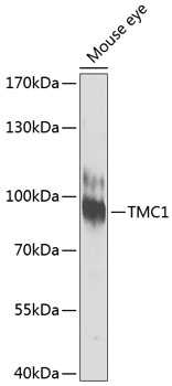 a07763 tmc1 primary antiboties wb testing 1