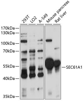 a07764 sec61a1 primary antiboties wb testing 1