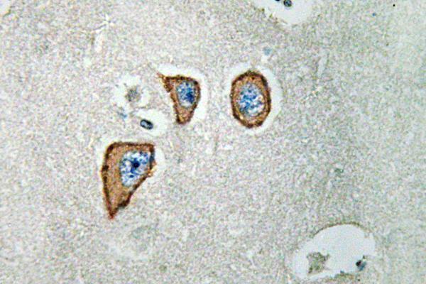 Immunohistochemistry analysis of NMDAε3 antibody in paraffin-embedded human brain tissue