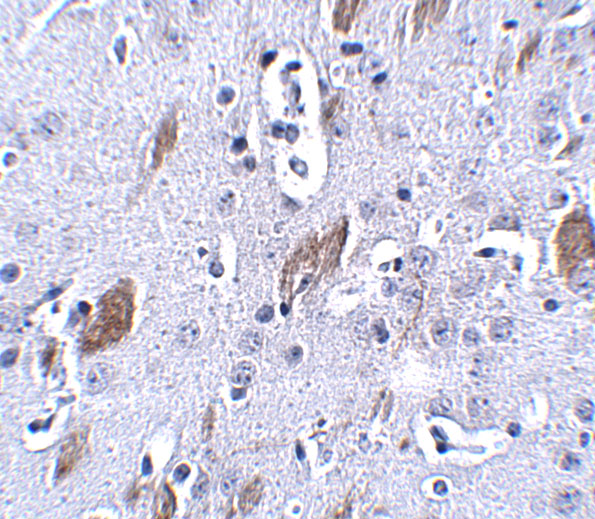 Immunohistochemistry of ATOH8 in mouse brain tissue with ATOH8 antibody at 5 μg/mL