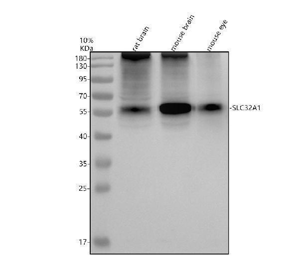 Western blot analysis of VGAT/SLC32A1 using anti-VGAT/SLC32A1 antibody (A07775-1)
