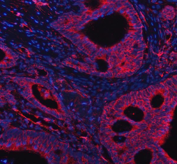IF analysis of PPM1F using anti-PPM1F antibody (AA07776-1)