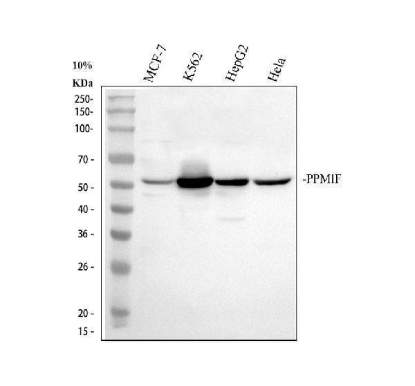 Western blot analysis of PPM1F using anti-PPM1F antibody (A07776-1)