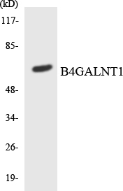 Western blot analysis of the lysates from COLO205 cells using B4GALNT1 antibody
