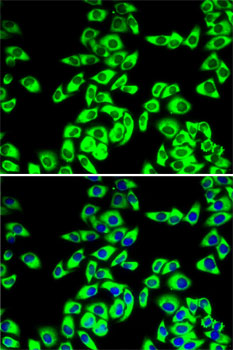 Immunofluorescence analysis of MCF7 cells using RPL14 antibody 