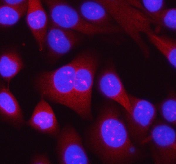  IF analysis of RPL14 using anti-RPL14 antibody (A07781-2)