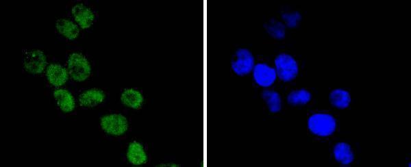 ICC staining CDC40 in Hela cells (green)