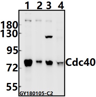 Western blot (WB) analysis of Cdc40 (S209) pAb at 1:500 dilution
Lane1:HEK293T whole cell lysate(10ug)
Lane2:MCF-7 whole cell lysate(10ug)
Lane3:CT26 whole cell lysate(10ug)
Lane4:The Brain tissue lysate of Rat(40ug)