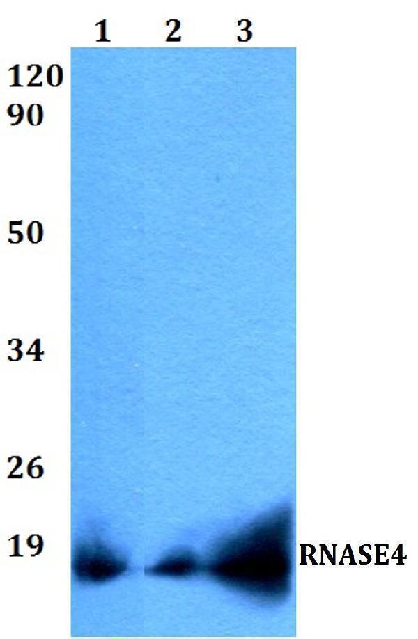 Western blot (WB) analysis of RNASE4 polyclonal antibody at 1:500 dilution
Lane1:HEK293T whole cell lysate
Lane2:sp2/0 whole cell lysate 
Lane3:PC12 whole cell lysate 