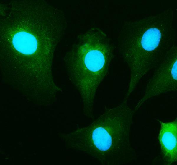 IF analysis of EIF3K using anti-EIF3K antibody (A07789-3)