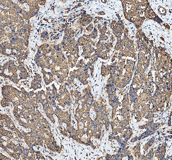 IHC analysis of EIF3K using anti-EIF3K antibody (A07789-3)